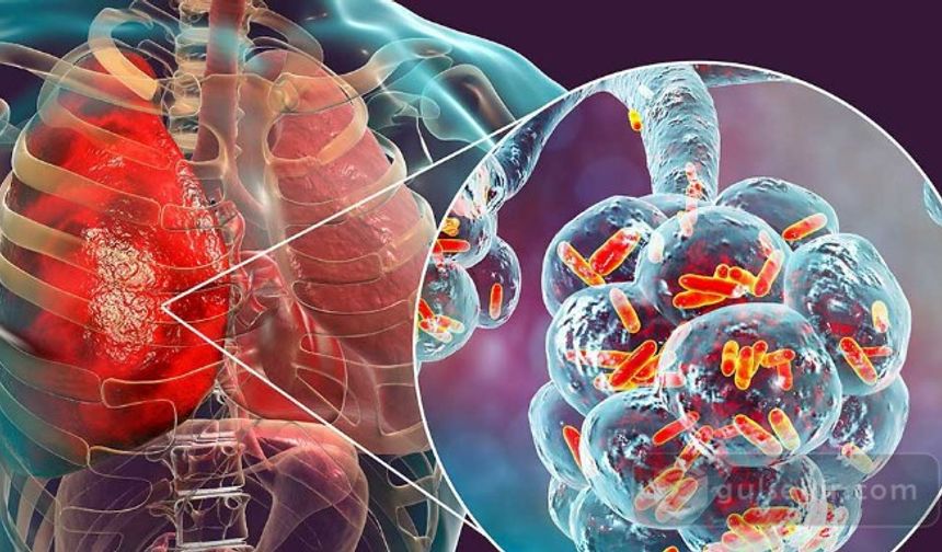 Lejyoner Hastalığı Alarmı: Yaz Aylarında Klima Kullanımının Tehlikeleri